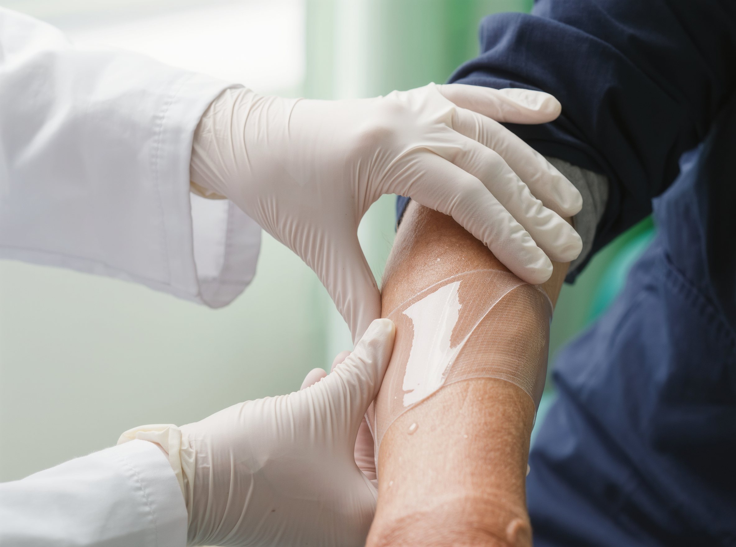 Clinician applying a gel dressing